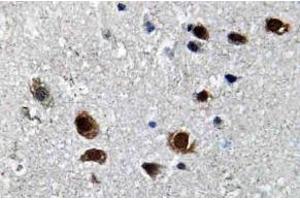 Immunohistochemistry analysis of SCN2A Antibody in paraffin-embedded human brain tissue. (SCN2A 抗体)