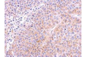 Image no. 1 for anti-Tubulin, beta (TUBB) (AA 160-447) antibody (ABIN1501915) (TUBB 抗体  (AA 160-447))