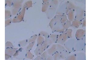 Detection of IkBd in Mouse Skeletal muscle Tissue using Polyclonal Antibody to Inhibitory Subunit Of NF Kappa B Delta (IkBd) (IkBd 抗体  (AA 58-304))
