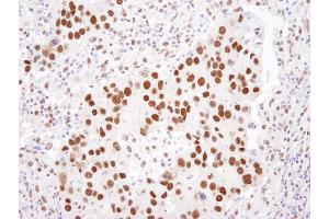 anti-Histone Deacetylase 2 (HDAC2) (C-Term) antibody