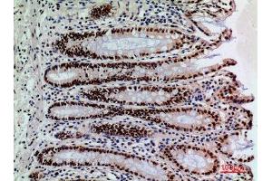 Immunohistochemistry (IHC) analysis of paraffin-embedded Human Colon, antibody was diluted at 1:100. (SLAMF1 抗体  (Tyr1096))