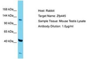 Image no. 1 for anti-Zinc Finger Protein 445 (ZNF445) (AA 406-455) antibody (ABIN6750286) (ZNF445 抗体  (AA 406-455))
