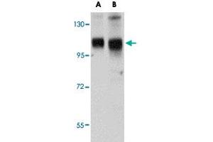 Western blot analysis of SH3BP4 in rat lung tissue lysate with SH3BP4 polyclonal antibody  at (A) 1 and (B) 2 ug/mL . (SH3BP4 抗体  (C-Term))