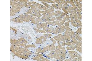 Immunohistochemistry of paraffin-embedded Rat heart using CAST Polyclonal Antibody at dilution of 1:100 (40x lens). (Calpastatin 抗体)
