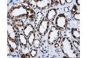 Immunohistochemical staining of paraffin-embedded liver tissue using anti-APP mouse monoclonal antibody. (APP 抗体)