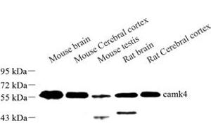 Western blot analysis of camk4 (ABIN7073281) at dilution of 1: 500 (CAMK4 抗体)
