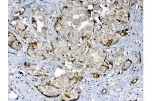 Immunohistochemistry (IHC) image for anti-Glutamate Decarboxylase 2 (Pancreatic Islets and Brain, 65kDa) (GAD2) (AA 84-182) antibody (ABIN5693229)