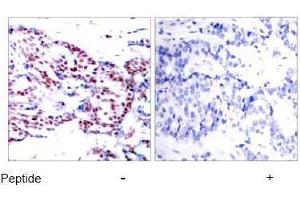 Image no. 4 for anti-Activating Transcription Factor 2 (ATF2) (Thr53), (Thr71) antibody (ABIN197149) (ATF2 抗体  (Thr53, Thr71))