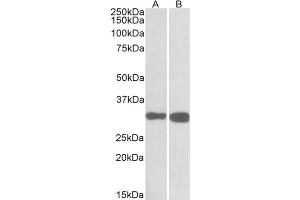 AP31565PU-N PDXP antibody staining of Mouse (A) and Rat (B) Brain lysates at 0. (PDXP 抗体  (C-Term))