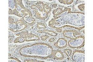 IHC analysis of HSPD1 using anti-HSPD1 antibody (ABIN7600976). (HSPD1 抗体  (AA 260-496))