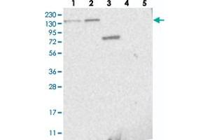 Western blot analysis of Lane 1: RT-4, Lane 2: U-251 MG, Lane 3: Human Plasma, Lane 4: Liver, Lane 5: Tonsil with PPP2R3A polyclonal antibody  at 1:250-1:500 dilution.