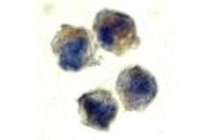 Immunohistochemistry (IHC) image for anti-Interleukin 22 Receptor (IL22R) (N-Term) antibody (ABIN1031411) (IL22R 抗体  (N-Term))