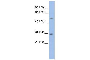 SMAP1 antibody used at 1 ug/ml to detect target protein. (SMAP1 抗体  (Middle Region))