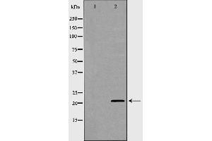 Western blot analysis of Hela whole cell lysates, using p21 Cip1 Antibody. (p21 抗体  (Internal Region))