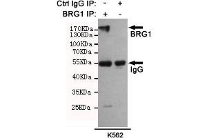 Immunoprecipitation analysis of K562 cell lysates using BRG1 mouse mAb (201025). (SMARCA4 抗体)