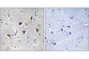 Immunohistochemistry (IHC) image for anti-Mitochondrial Transcription Termination Factor (MTERF) (AA 267-316) antibody (ABIN2890668) (MTERF 抗体  (AA 267-316))