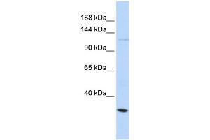 WB Suggested Anti-KCNMA1 Antibody Titration:  0. (KCNMA1 抗体  (Middle Region))