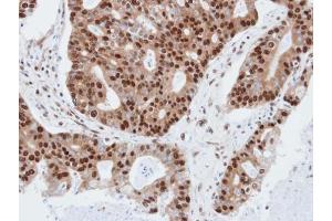 IHC-P Image Immunohistochemical analysis of paraffin-embedded human endo mitral, using PDE4C, antibody at 1:100 dilution. (PDE4C 抗体)