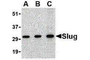 Western Blotting (WB) image for anti-SLUG (Center) antibody (ABIN2476524) (SLUG 抗体  (Center))