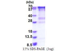 RNGTT Protein (AA 1-597) (His tag)