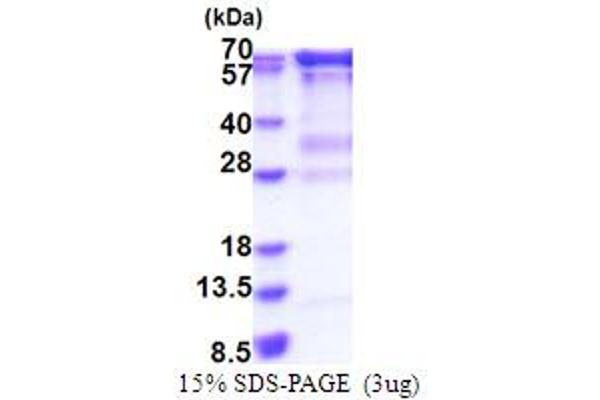 RNGTT Protein (AA 1-597) (His tag)