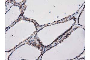 Image no. 1 for anti-Catenin (Cadherin-Associated Protein), beta 1, 88kDa (CTNNB1) antibody (ABIN1496890) (CTNNB1 抗体)