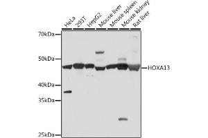 Western blot analysis of extracts of various cell lines, using HOX Rabbit mAb (ABIN7267762) at 1:500 dilution. (HOXA13 抗体)