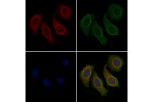ABIN6257536 and ABIN6274704 staining Hela cells by IF/ICC. (TRAF3IP3 抗体  (Internal Region))