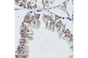 Immunohistochemistry of paraffin-embedded mouse testis using HEXA antibody (ABIN6290114) at dilution of 1:100 (40x lens). (Hexosaminidase A 抗体)