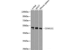 Western blot analysis of extracts of various cell lines using CSNK1G1 Polyclonal Antibody at dilution of 1:1000. (CSNK1G1 抗体)