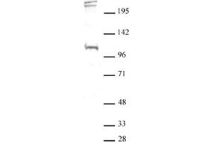 Western blot of BLIMP1 / PRDM1 antibody. (PRDM1 抗体  (N-Term))