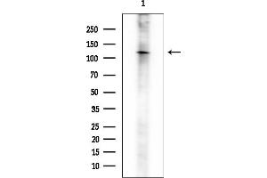 anti-Solute Carrier Family 9, Member C2 (SLC9C2) (Internal Region) antibody
