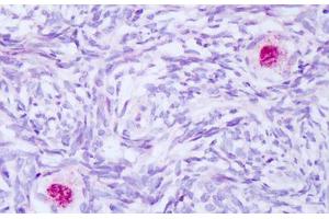 Image no. 2 for anti-BCL2-Associated Athanogene (BAG1) (AA 112-161) antibody (ABIN6749782) (BAG1 抗体  (AA 112-161))