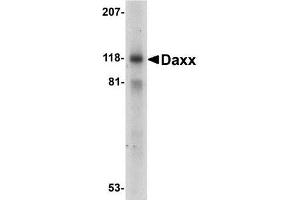 Western blot analysis of Daxx in 293 whole cell lysate with Daxx antibody at 1ug/ml. (DAXX 抗体)