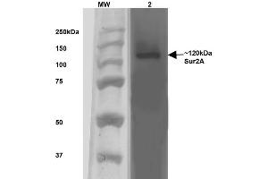 Western Blotting (WB) image for anti-ATP-Binding Cassette, Sub-Family C (CFTR/MRP), Member 9 (ABCC9) (AA 1505-1546) antibody (Biotin) (ABIN2482978)