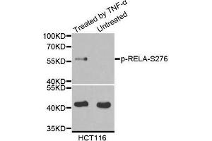 Western blot analysis of extract from Hela cells using Phospho-RELA-S276 antibody. (NF-kB p65 抗体  (pSer276))