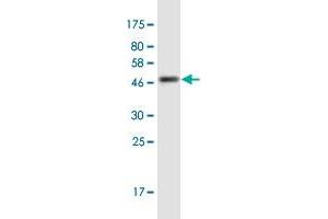 Western Blot detection against Immunogen (45. (CCDC12 抗体  (AA 1-166))