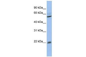 WB Suggested Anti-NR0B1 Antibody Titration: 0. (NR0B1 抗体  (Middle Region))