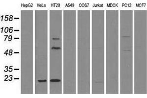 Western blot analysis of extracts (35 µg) from 9 different cell lines by using anti-CD4 monoclonal antibody. (CD4 抗体)