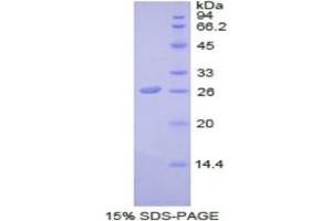 SDS-PAGE analysis of Human SDF4 Protein. (SDF4 蛋白)