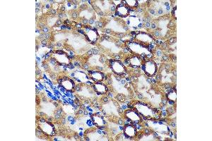 Immunohistochemistry of paraffin-embedded Mouse kidney using TMX2 Rabbit pAb (ABIN7270810) at dilution of 1:100 (40x lens). (TMX2 抗体  (AA 128-296))