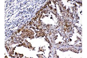 IHC analysis of MED9 using anti-MED9 antibody . (MED9 抗体  (AA 55-146))
