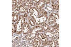 Immunohistochemical staining (Formalin-fixed paraffin-embedded sections) of human kidney with MACC1 polyclonal antibody  shows moderate cytoplasmic positivity in cells in tubules. (MACC1 抗体)