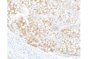 Immunohistochemistry (IHC) image for anti-Fibrinogen-Like 1 (FGL1) (AA 18-312) antibody (ABIN7453972) (Recombinant FGL1 抗体  (AA 18-312))