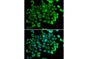 Immunofluorescence analysis of U2OS cells using APOBEC3C antibody (ABIN5973484). (APOBEC3C 抗体)