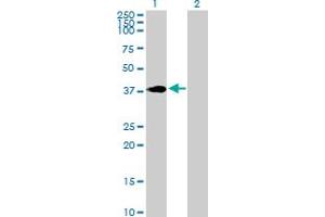 Western Blot analysis of HOXC4 expression in transfected 293T cell line by HOXC4 MaxPab polyclonal antibody. (HOXC4 抗体  (AA 1-264))