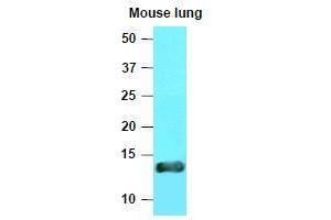 Western Blotting (WB) image for anti-Vesicle-Associated Membrane Protein 3 (VAMP3) (AA 1-77), (N-Term) antibody (ABIN336092) (VAMP3 抗体  (N-Term))