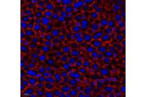 Immunofluorescence of paraffin embedded mouse liver using THNSL2 (ABIN7075893) at dilution of 1: 400 (400x lens) (THNSL2 抗体)