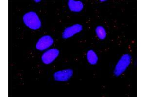 Proximity Ligation Analysis of protein-protein interactions between PRKCD and GRM5. (Metabotropic Glutamate Receptor 5 抗体  (AA 419-518))