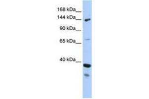 DHX37 Antikörper  (AA 71-120)